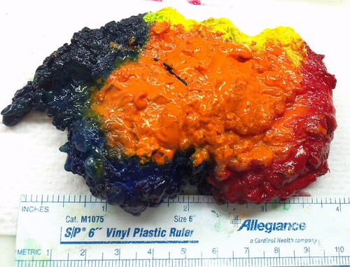 What Turns an AI Pathology Tool into a Companion Diagnostic?